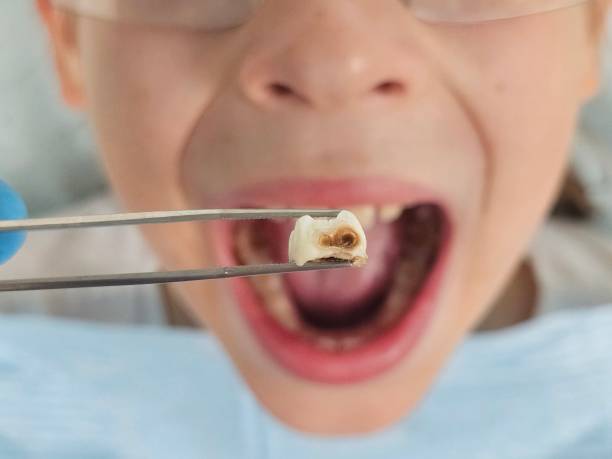 Best Orthodontic Emergency Dentist in Hardwick, GA